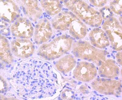 Immunohistochemistry-Paraffin: IL-1 beta/IL-1F2 Antibody (JJ087-3) [NBP2-67865] - Analysis of paraffin-embedded human kidney tissue using anti-IL1 beta antibody. Counter stained with hematoxylin.