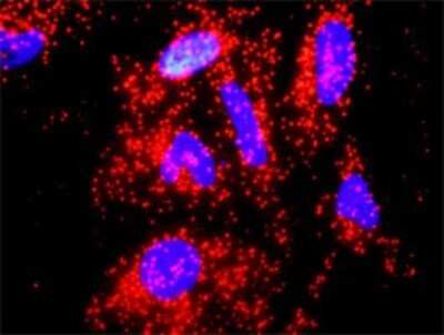Proximity Ligation Assay: IL-10 Antibody [H00003586-D01P] - Analysis of protein-protein interactions between IL10 and A2M. HeLa cells were stained with anti-IL10 rabbit purified polyclonal 1:1200 and anti-A2M mouse monoclonal antibody 1:50. Each red dot represents the detection of protein-protein interaction complex, and nuclei were counterstained with DAPI (blue).