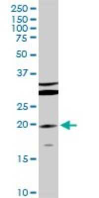 Western Blot: IL-10 Antibody [H00003586-D01P] - Analysis of IL10 expression in Jurkat.