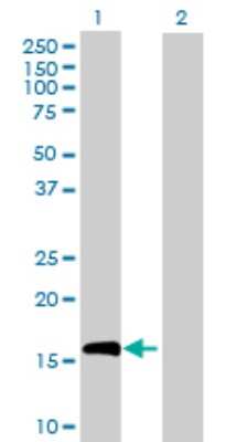 Western Blot: IL-10 Antibody [H00003586-D01P] - Analysis of IL10 expression in transfected 293T cell line by IL10 polyclonal antibody.Lane 1: IL10 transfected lysate(20.50 KDa).Lane 2: Non-transfected lysate.