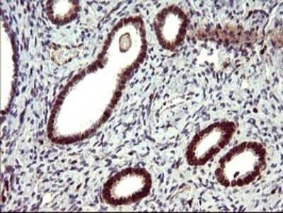 Immunohistochemistry: IL-10R alpha Antibody (OTI1D10) - Azide and BSA Free [NBP2-71030] - Analysis of Human endometrium tissue. (Heat-induced epitope retrieval by 10mM citric buffer, pH6.0, 120C for 3min)