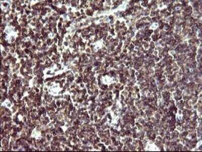 Immunohistochemistry: IL-10R alpha Antibody (OTI1D10) - Azide and BSA Free [NBP2-71030] - Analysis of Human lymph node tissue. (Heat-induced epitope retrieval by 10mM citric buffer, pH6.0, 120C for 3min)