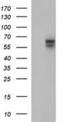 Western Blot: IL-10R alpha Antibody (OTI1D10) - Azide and BSA Free [NBP2-71030] - Analysis of HEK293T cells were transfected with the pCMV6-ENTRY control (Left lane) or pCMV6-ENTRY IL-10 R alpha.