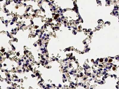 Immunohistochemistry-Paraffin: IL-12/IL-23 p40 Antibody [NBP2-98436] - Immunochemical staining of rat IL-12/IL-23 p40 in rat lung with rabbit polyclonal antibody (1:1000, formalin-fixed paraffin embedded sections).