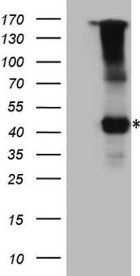 Western Blot: IL-12 R beta 1 Antibody (OTI1A6) - Azide and BSA Free [NBP2-71033] - Analysis of HEK293T cells were transfected with the pCMV6-ENTRY control (Left lane) or pCMV6-ENTRY IL-12 R beta.