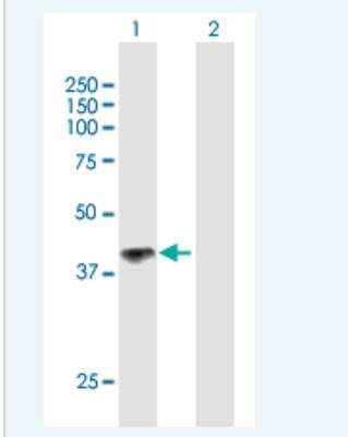 Western Blot: IL-12 R beta 1 Antibody [H00003594-B01P-50ug] - Analysis of IL12RB1 expression in transfected 293T cell line (H00003594-T01) by IL12RB1 MaxPab polyclonal antibody.  Lane 1: IL12RB1 transfected lysate(42.02 KDa). Lane 2: Non-transfected lysate.