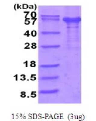 SDS-Page: IL-12 R beta 1 Recombinant Protein [NBP2-51952] - 15% SDS Page (3 ug)