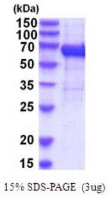 SDS-Page: Recombinant Human IL-12 R beta 1 Protein [NBP2-52085] -  15% SDS Page (3 ug)