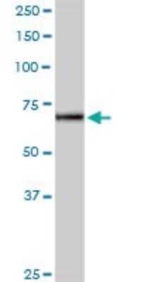 Western Blot: IL-12 R beta 2 Antibody [H00003595-D01P] - Analysis of IL12RB2 expression in human spleen.