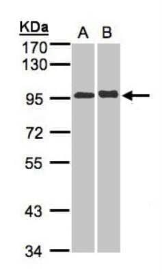 Western Blot: IL-12 R beta 2 Antibody [NBP1-32558] - Sample(30 ug whole cell lysate)A:A431 B: Hep G2 7. 5% SDS PAGE, antibody diluted at 1:5000.