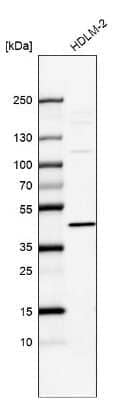 Western Blot: IL-13 R alpha 1 Antibody [NBP2-55120] - Analysis in human cell line HDLM-2.