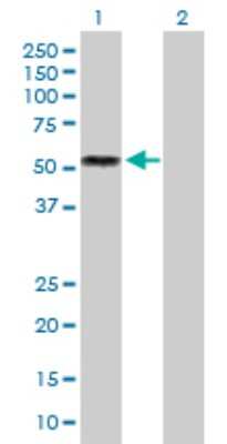 Western Blot: IL-13 R alpha 2 Antibody [H00003598-D01P] - Analysis of IL13RA2 expression in transfected 293T cell line by IL13RA2 polyclonal antibody.Lane 1: IL13RA2 transfected lysate(44.20 KDa).Lane 2: Non-transfected lysate.