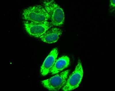 Immunocytochemistry/Immunofluorescence: IL-13R alpha 1 Antibody (JU38-89) [NBP2-75538] - Staining IL13 Receptor alpha 1 in HepG2 cells (green). The nuclear counter stain is DAPI (blue). Cells were fixed in paraformaldehyde, permeabilised with 0.25% Triton X100/PBS.