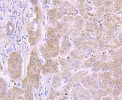 Immunohistochemistry-Paraffin: IL-13R alpha 1 Antibody (JU38-89) [NBP2-75538] - Analysis of paraffin-embedded human liver tissue using anti-IL13 Receptor alpha 1 antibody. Counter stained with hematoxylin.