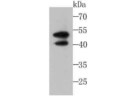 Western Blot: IL-13R alpha 1 Antibody (JU38-89) [NBP2-75538] - Analysis of IL13 Receptor alpha 1 on A549 cell lysates using anti-IL13 Receptor alpha 1 antibody at 1/500 dilution.