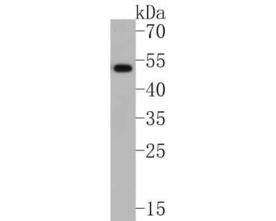 Western Blot: IL-13R alpha 1 Antibody (JU38-89) [NBP2-75538] - Western blot analysis of IL-13R alpha 1 on HepG2 cell lysates. Proteins were transferred to a PVDF membrane and blocked with 5% BSA in PBS for 1 hour at room temperature. The primary antibody (1/500) was used in 5% BSA at room temperature for 2 hours. Goat Anti-Rabbit IgG - HRP Secondary Antibody (HA1001) at 1:200,000 dilution was used for 1 hour at room temperature.