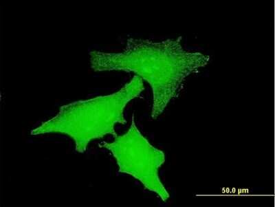 Immunocytochemistry/Immunofluorescence: IL-15 Antibody (1H8) [H00003600-M04] - Analysis of monoclonal antibody to IL15 on HeLa cell. Antibody concentration 10 ug/ml