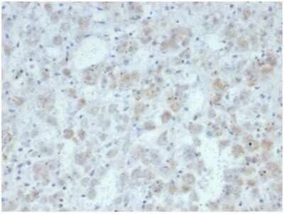 Immunohistochemistry-Paraffin: IL-15 Antibody (IL15/7048R) [NBP3-13950] - Formalin-fixed, paraffin-embedded human adrenal gland stained with IL-15 antibody (IL15/7048R). HIER: Tris/EDTA, pH9.0, 45min. HRP-polymer, 30min. DAB, 5min.