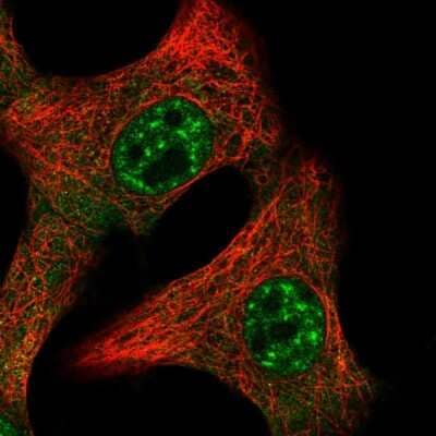 Immunocytochemistry/Immunofluorescence: IL-15 Antibody [NBP2-55162] - Staining of human cell line A549 shows localization to nuclear speckles & cytosol. Antibody staining is shown in green.