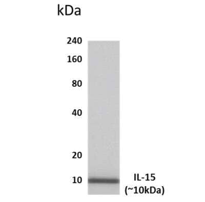 Western Blot: IL-15 Antibody (MM0368-13S34) [NBP2-11665] - Lysates of human placental tissue.