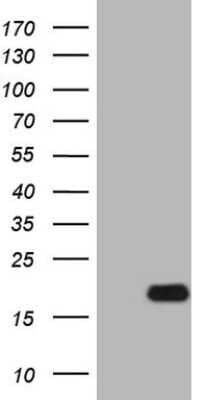 Western Blot: IL-15 Antibody (OTI2B4) - Azide and BSA Free [NBP2-71034] - Analysis of HEK293T cells were transfected with the pCMV6-ENTRY control (Left lane) or pCMV6-ENTRY IL15.