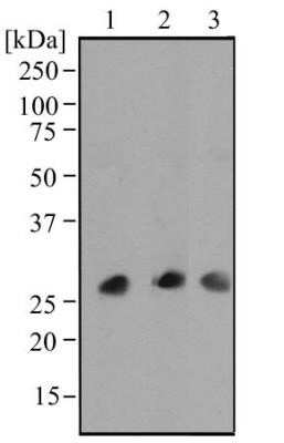 Western Blot: IL-17/IL-17A Antibody (4k5f6) - Azide Free [NBP2-46611] - Analysis of human serum (albumin-depleted) (1), human plasma (albumin-depleted) (2), and human lymph node tissue (3) using IL17 antibody at a concentration of 2 ug/mL. Image from the standard format of this antibody.