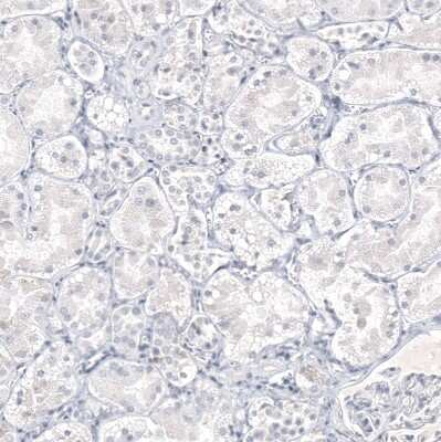 Immunohistochemistry-Paraffin: IL-17/IL-17A Antibody (CL10252) [NBP3-07997] - Staining of human kidney shows no positivity in cells in tubules as expected.