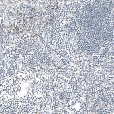 Immunohistochemistry-Paraffin: IL-17/IL-17A Antibody (CL10252) [NBP3-07997] - Staining of human lymph node shows moderate cytoplasmic positivity in a subset of lymphoid cells.
