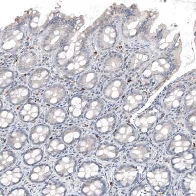 Immunohistochemistry-Paraffin: IL-17/IL-17A Antibody (CL10252) [NBP3-07997] - Staining of human rectum shows moderate cytoplasmic positivity in lymphoid cells.