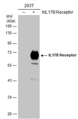 Western Blot: IL-17 RB Antibody [NBP2-43767] - Non-transfected (-) and transfected (+) 293T whole cell extracts (30 ug) were separated by 10% SDS-PAGE, and the membrane was blotted with IL-17 RB antibody diluted at 1:1000.