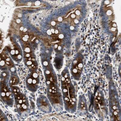 Immunohistochemistry-Paraffin: IL-17 RC Antibody [NBP1-83112] - Staining of human duodenum shows strong cytoplasmic positivity in glandular cells.