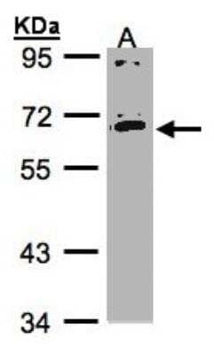 Western Blot: IL-17RC Antibody [NBP1-32481] - Sample(30 ug whole cell lysate)  A:HeLa S3 7. 5% SDS PAGE, antibody diluted at 1:1000.