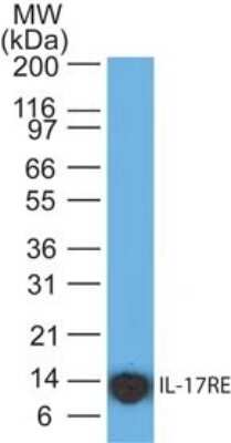 Western Blot: IL-17 RE Antibody (46N8G7) - Azide Free [NBP2-27366] - Analysis of IL-17RE using a partial recombinant protein (amino acids 97-199) probed with NBP2-27366 antibody at 5 ug/ml. Goat anti-mouse Ig HRP secondary antibody and PicoTect ECL substrate solution were used for this test.