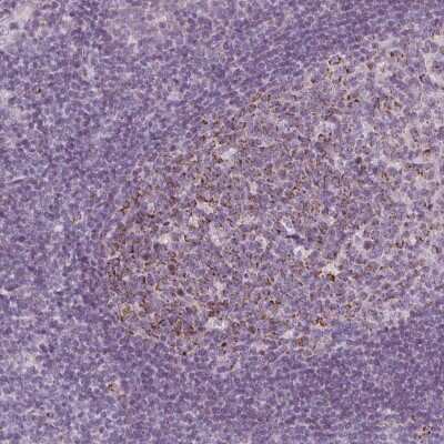 Immunohistochemistry: IL-17C Antibody [NBP2-39046] - Staining of human tonsil shows moderate granular cytoplasmic positivity in germinal center cells.