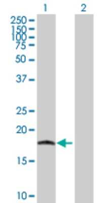 Western Blot: IL-17C Antibody [H00027189-B01P] - Analysis of IL17C expression in transfected 293T cell line by IL17C polyclonal antibody.  Lane 1: IL17C transfected lysate(21.67 KDa). Lane 2: Non-transfected lysate.