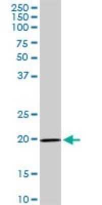 Western Blot: IL-17D Antibody [H00053342-D01P] - Analysis of IL17D expression in A-431.