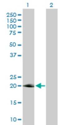 Western Blot: IL-17D Antibody [H00053342-D01P] - Analysis of IL17D expression in transfected 293T cell line by IL17D polyclonal antibody.Lane 1: IL17D transfected lysate(21.90 KDa).Lane 2: Non-transfected lysate.