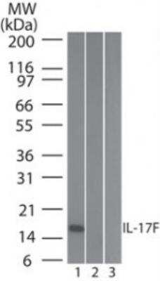 Western Blot: IL-17F Antibody (4H450) - Azide Free [NBP2-27319] - Analysis of IL-17F in 1) human, 2) mouse and 3) rat full-length recombinant IL-17F protein using IL-17F antibody at 0.2 ug/ml.