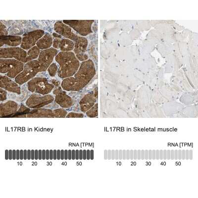 Immunohistochemistry-Paraffin: IL-17RB Antibody [NBP1-85450] - Analysis in human kidney and skeletal muscle tissues using NBP1-85450 antibody. Corresponding IL17RB RNA-seq data are presented for the same tissues.