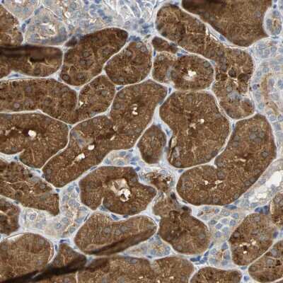 Immunohistochemistry-Paraffin: IL-17RB Antibody [NBP1-85450] - Staining of human kidney shows strong cytoplasmic positivity in cells in tubules.