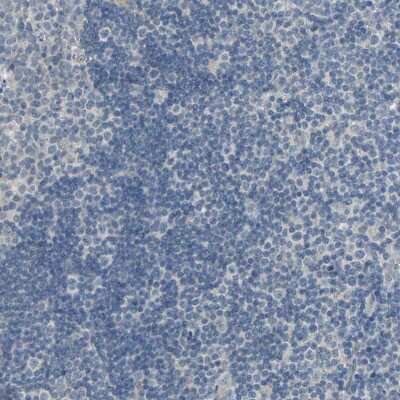 Immunohistochemistry-Paraffin: IL-17RB Antibody [NBP1-85450] - Staining of human lymphoid tissues shows no positivity in non-germinal center cells as expected.