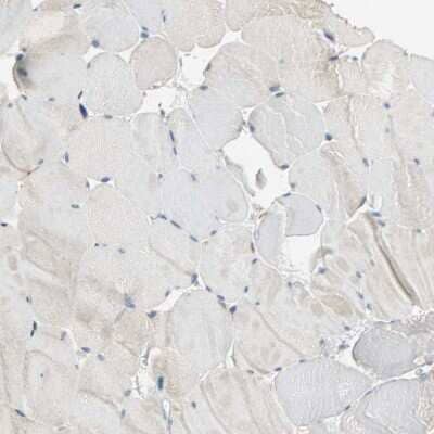 <b>Orthogonal Strategies Validation. </b>Immunohistochemistry-Paraffin: IL-17RB Antibody [NBP1-85450] - Staining of human skeletal muscle shows no positivity in myocytes as expected.