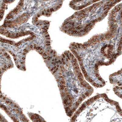 Immunohistochemistry-Paraffin: IL-17RE Antibody [NBP1-93925] - Staining of human Fallopian tube shows strong cytoplasmic / membranous positivity in glandular cells.