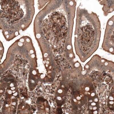 Immunohistochemistry-Paraffin: IL-17RE Antibody [NBP1-93925] - Staining of human duodenum shows strong membranous positivity in glandular cells.