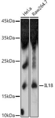 Western Blot: IL-18/IL-1F4 Antibody [NBP3-03699] - Analysis of extracts of various cell lines, using IL18 antibody  at 1:1000 dilution.Secondary antibody: HRP Goat Anti-Rabbit IgG (H+L)  at 1:10000 dilution.Lysates/proteins: 25ug per lane. Blocking buffer: 3% nonfat dry milk in TBST.Detection: ECL Enhanced Kit. Exposure time: 180s.