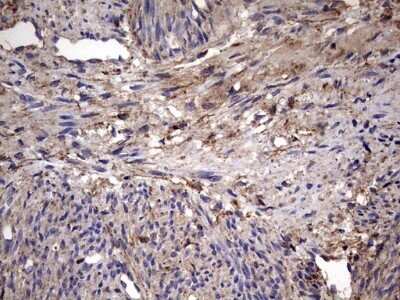 Immunohistochemistry: IL-1ra/IL-1F3/IL1RN Antibody (OTI2B1) - Azide and BSA Free [NBP2-71022] - Analysis of Human endometrium tissue. (Heat-induced epitope retrieval by 1 mM EDTA in 10mM Tris, pH8.5, 120C for 3min)