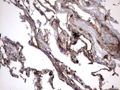 Immunohistochemistry: IL-1ra/IL-1F3/IL1RN Antibody (OTI2B1) - Azide and BSA Free [NBP2-71022] - Analysis of Human lung tissue. (Heat-induced epitope retrieval by 1 mM EDTA in 10mM Tris, pH8.5, 120C for 3min)