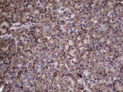Immunohistochemistry: IL-1ra/IL-1F3/IL1RN Antibody (OTI2B1) - Azide and BSA Free [NBP2-71022] - Analysis of Human pancreas tissue. (Heat-induced epitope retrieval by 1 mM EDTA in 10mM Tris, pH8.5, 120C for 3min)