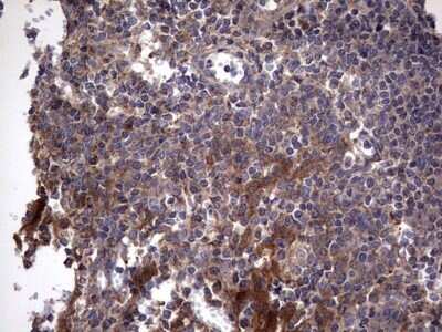 Immunohistochemistry: IL-1ra/IL-1F3/IL1RN Antibody (OTI2B1) - Azide and BSA Free [NBP2-71022] - Analysis of Human tonsil tissue. (Heat-induced epitope retrieval by 1 mM EDTA in 10mM Tris, pH8.5, 120C for 3min)