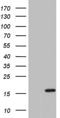 Western Blot: IL-1ra/IL-1F3/IL1RN Antibody (OTI2B1) - Azide and BSA Free [NBP2-71022] - Analysis of HEK293T cells were transfected with the pCMV6-ENTRY control (Left lane) or pCMV6-ENTRY IL1RN.